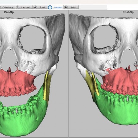 ３Dシミュレーションについて